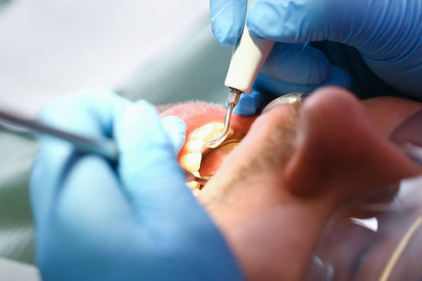 Best Walk-In Emergency Dentist in Chubbuck, ID