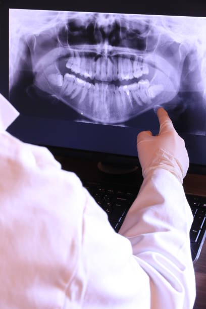 Best Emergency Tooth Extraction in Chubbuck, ID